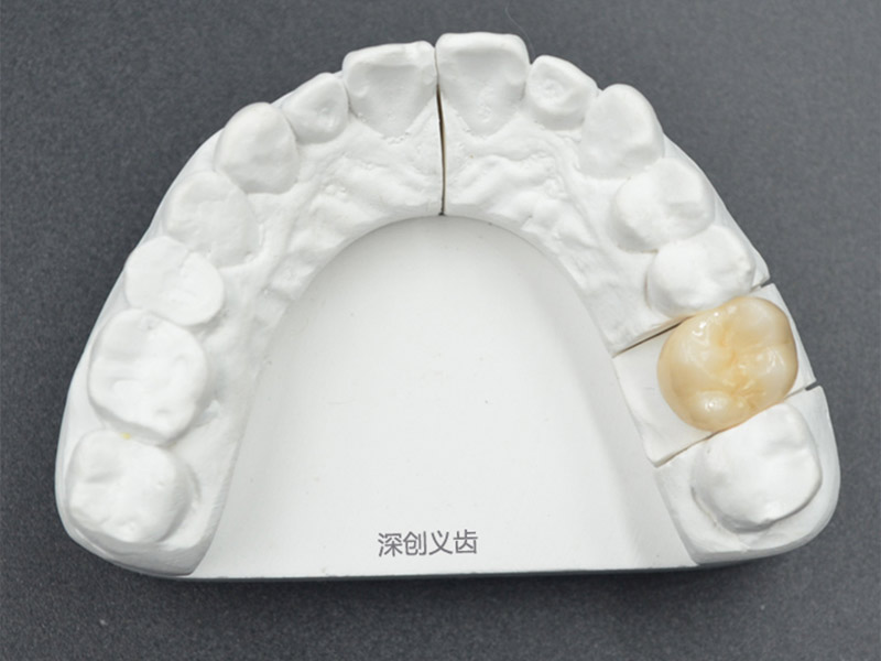 全瓷美容修复