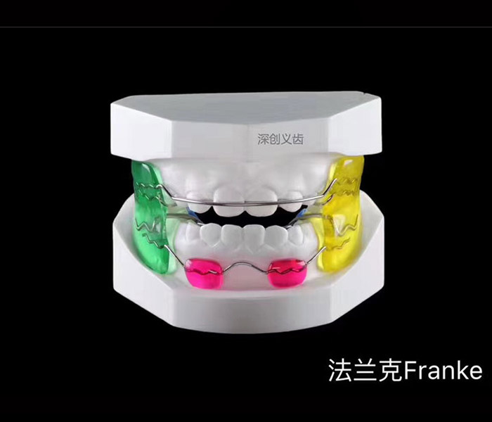 B-001-Frankel-(FR2)-法兰克2类