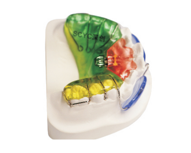 V-shaped pantograph expander+lip guard