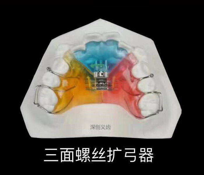 三面螺丝扩弓器-1