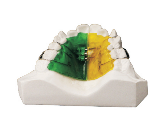 Double sided screw expander