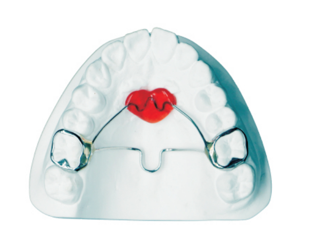 Lansi palatal arch+transverse palatal rod