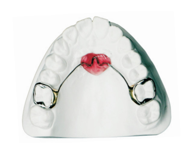 Lansi palatal arch