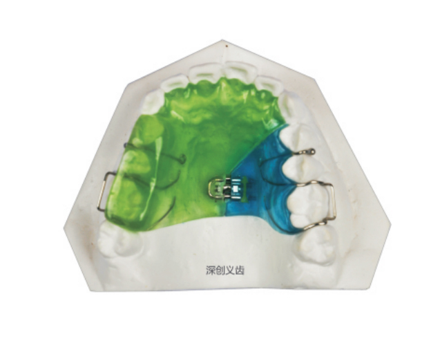 Single sided screw expander