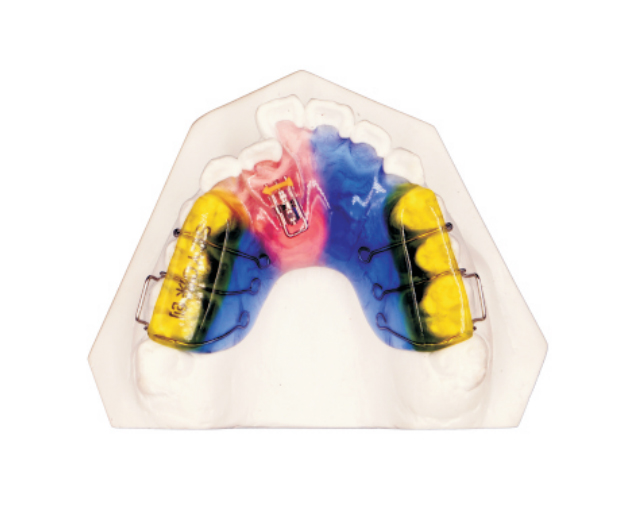 Single screw corrector+dental pad