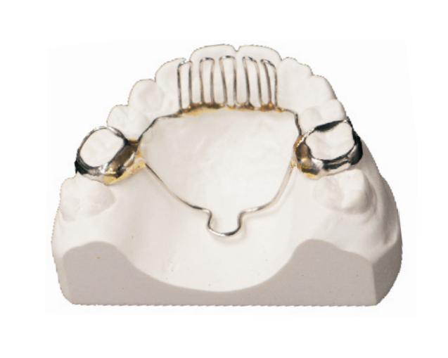 Tongue habit disruptor (tongue barrier)
