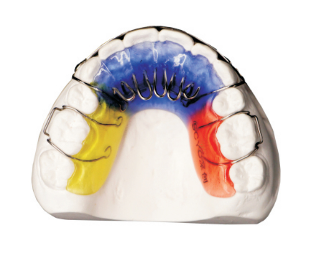 Tongue habit disruptor (tongue barrier)