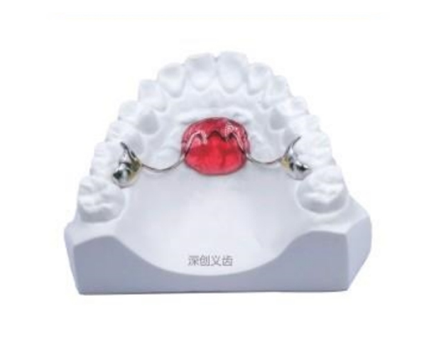 Lansi palatal arch