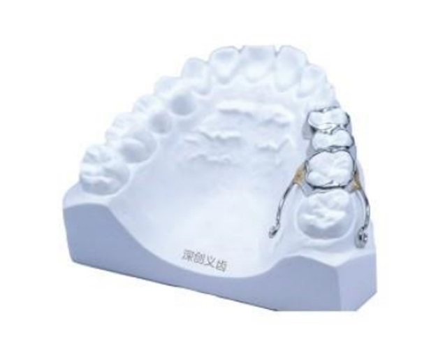 Unilateral molar depressor