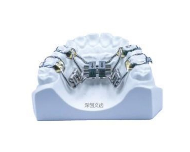 Rapid arch expansion and grinding device for teeth