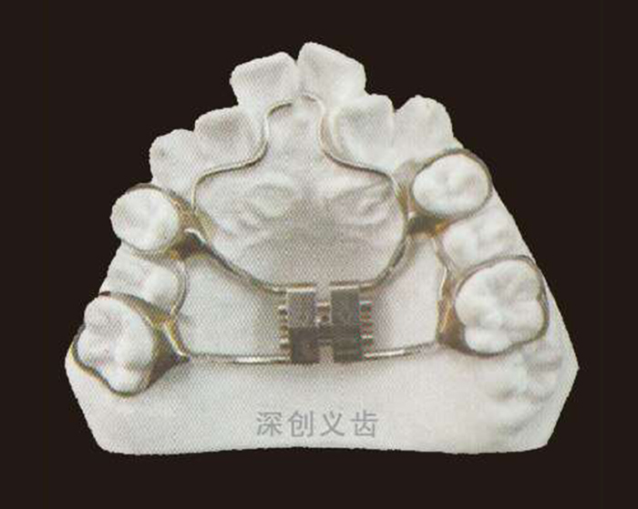 快速扩弓器(水平向）