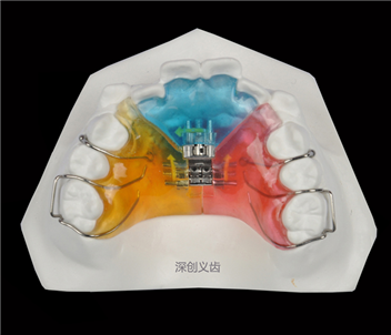 C-003三面螺丝扩弓器