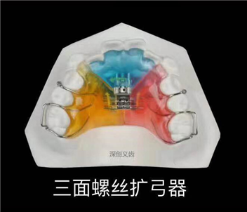 三面螺丝扩弓器-1