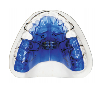 Double sided screw arch expansion+jaw pad