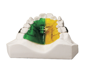 Double sided screw expander