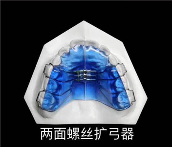 两面螺丝矫正器