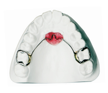 Lansi palatal arch