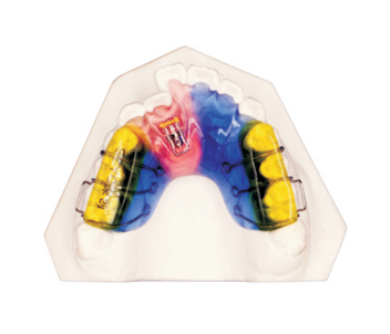 Single screw corrector+dental pad