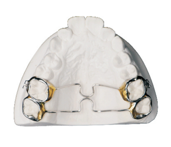 Double horizontal palatal rods