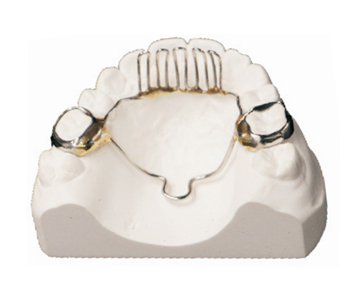 Tongue habit disruptor (tongue barrier)
