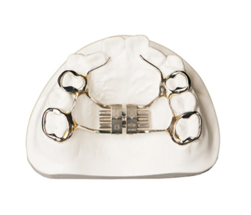Rapid Bow Expander (Horizontal Bow Expander)