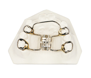 Rapid expansion device (sagittal expansion)
