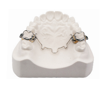 Model palatal rod (movable)