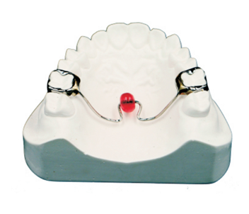 Horizontal palatal rod+tongue inducer