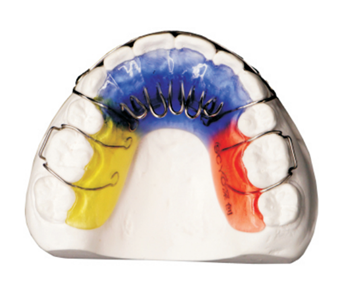 Tongue habit disruptor (tongue barrier)