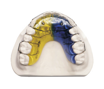 Screw aligner