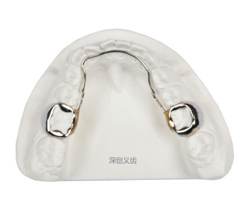 Gap maintainer (tongue arch)