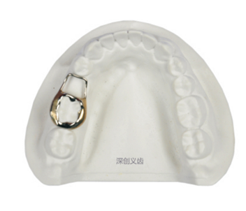 Gap retainers