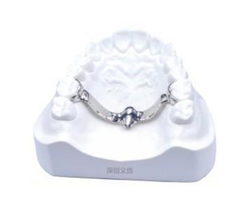 3D printed transverse palatal bar