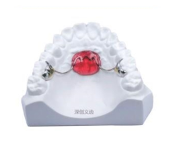 Lansi palatal arch