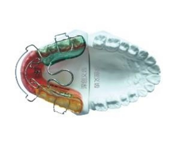 Ⅱ型功能矫治器
