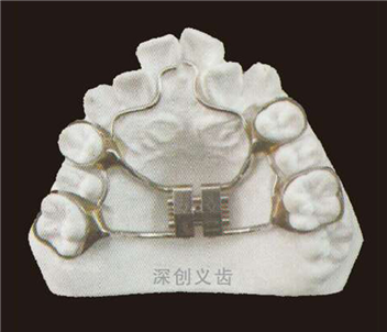 快速扩弓器(水平向）