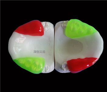 运动护齿套
