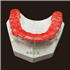 颞合关节虎牙咬合垫